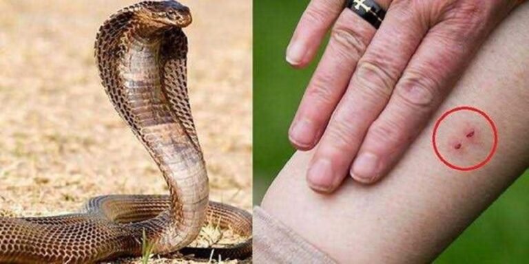 सांप के काटने पर तुरंत क्या करना चाहिए, इस तरीके से शरीर में जहर फैलने से रोक सकते हैं
